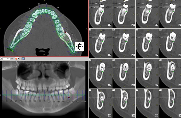 8-1-Dental2.jpg
