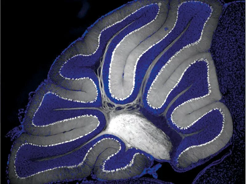 Brain cells could be manipulated using light.Credit: Esther Krook-Magnuson