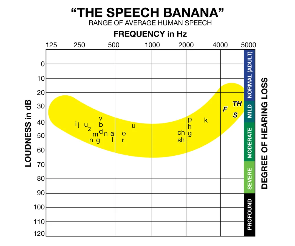 The "Speech Banana" and the Sounds of Human Speech — ClearValue With Blank Audiogram Template Download The "Speech Banana" and the Sounds of Human Speech — ClearValue With Blank Audiogram Template Download