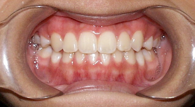 Union City Orthodontist | Dr. Scott Chong | Orthodontist Union City | Orthodontist | Teeth Straightening | Braces | Retainers | 94587