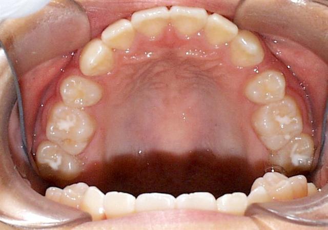 Union City Orthodontist | Dr. Scott Chong | Orthodontist Union City | Orthodontist | Teeth Straightening | Braces | Retainers | 94587