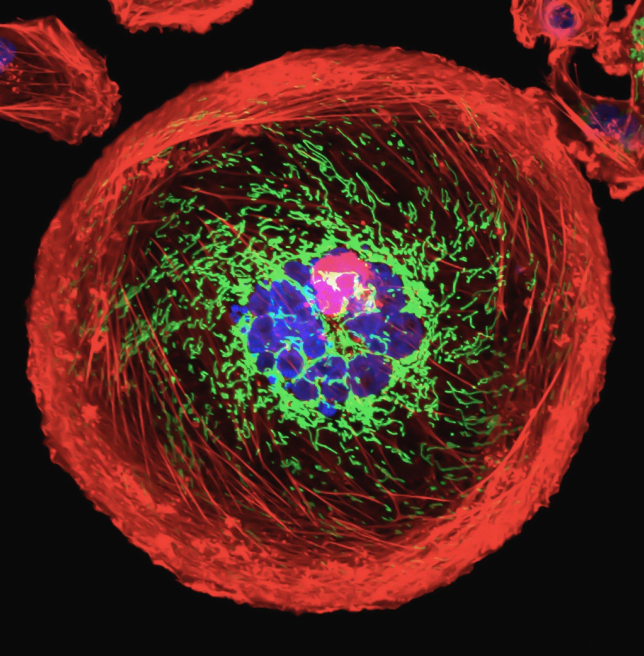 Unveiling the World's Largest Breast Tissue Map