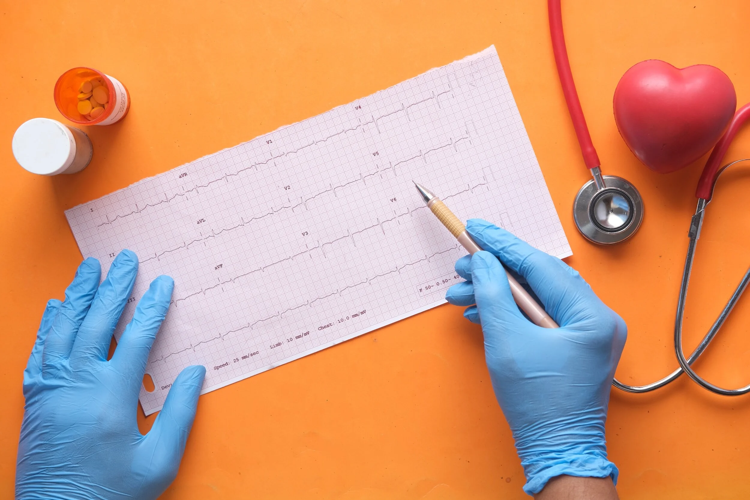 Canagliflozin: A Promising Solution for Type 2 Diabetes and Heart Disease Risks