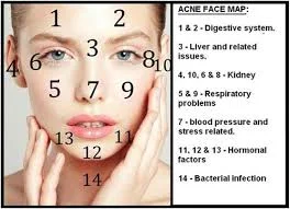 Acne map.jpg