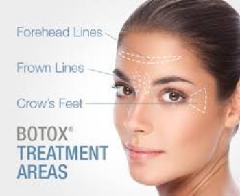 BOTOX — Estevan Laser Health Clinic