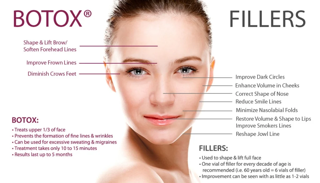 BotoxFillersInfographic-4-1-1024x659.jpg