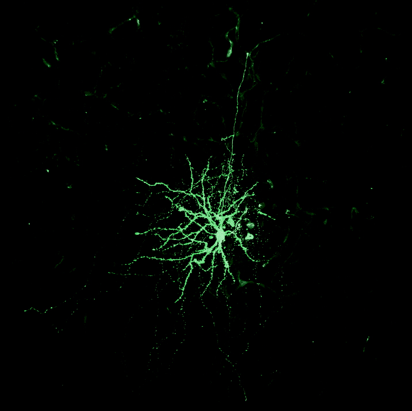 Dance between neuron and vasculature_2.jpg
