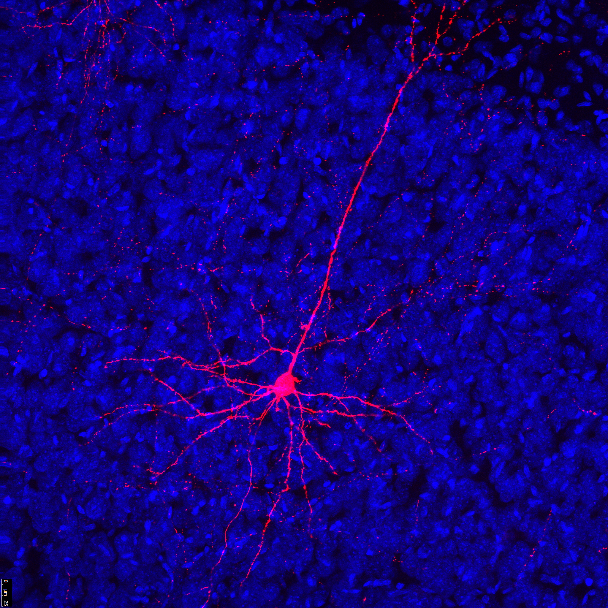 P14-AAV-RFP neuron and glia.lif_Neuron_Processed001_ch01.jpg