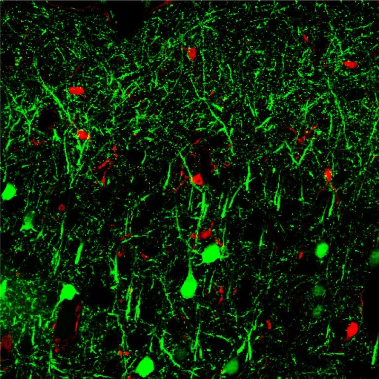 Our latest publication found evidence that microRNAs might help with early detection of Alzheimer's disease