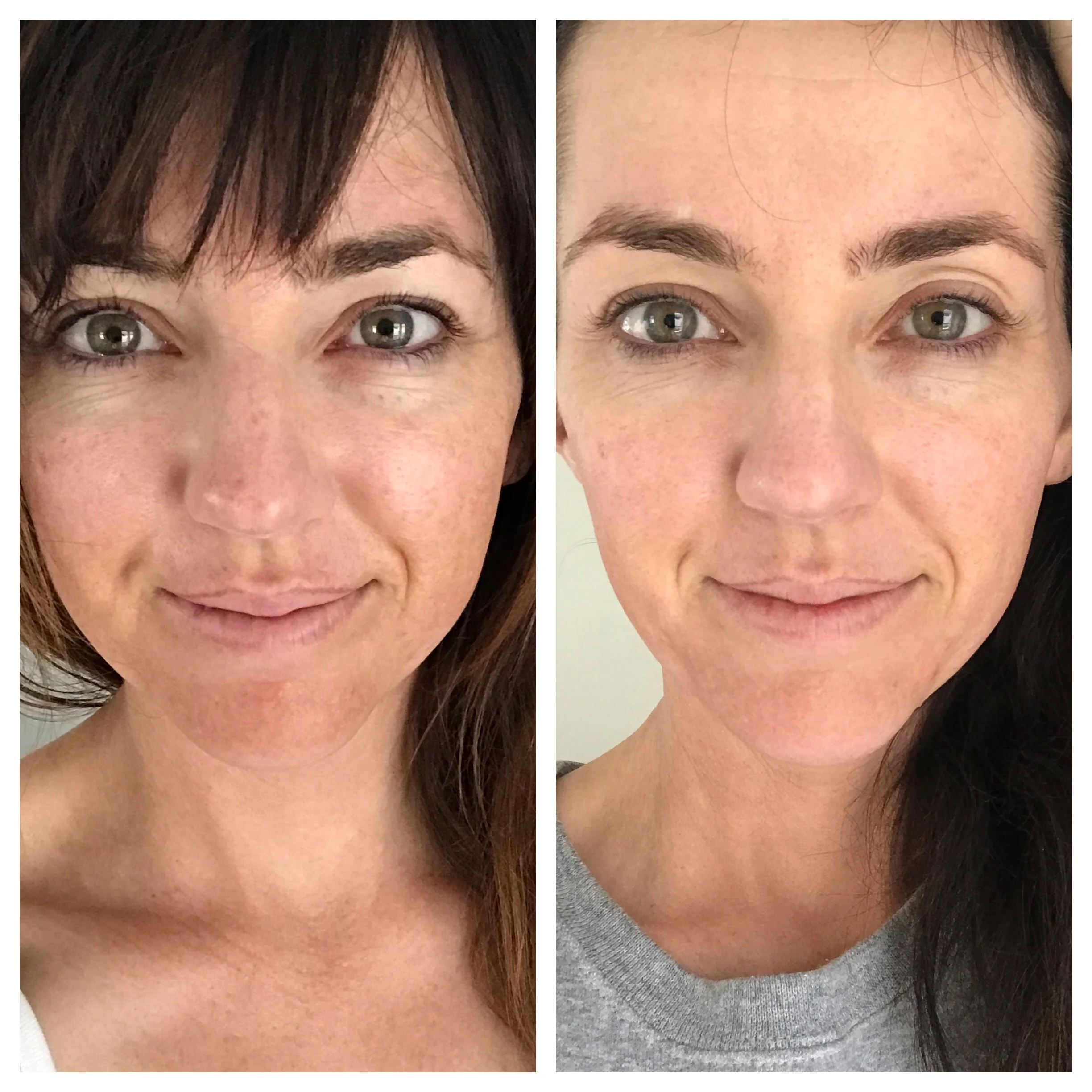 biossance eye cream before and after