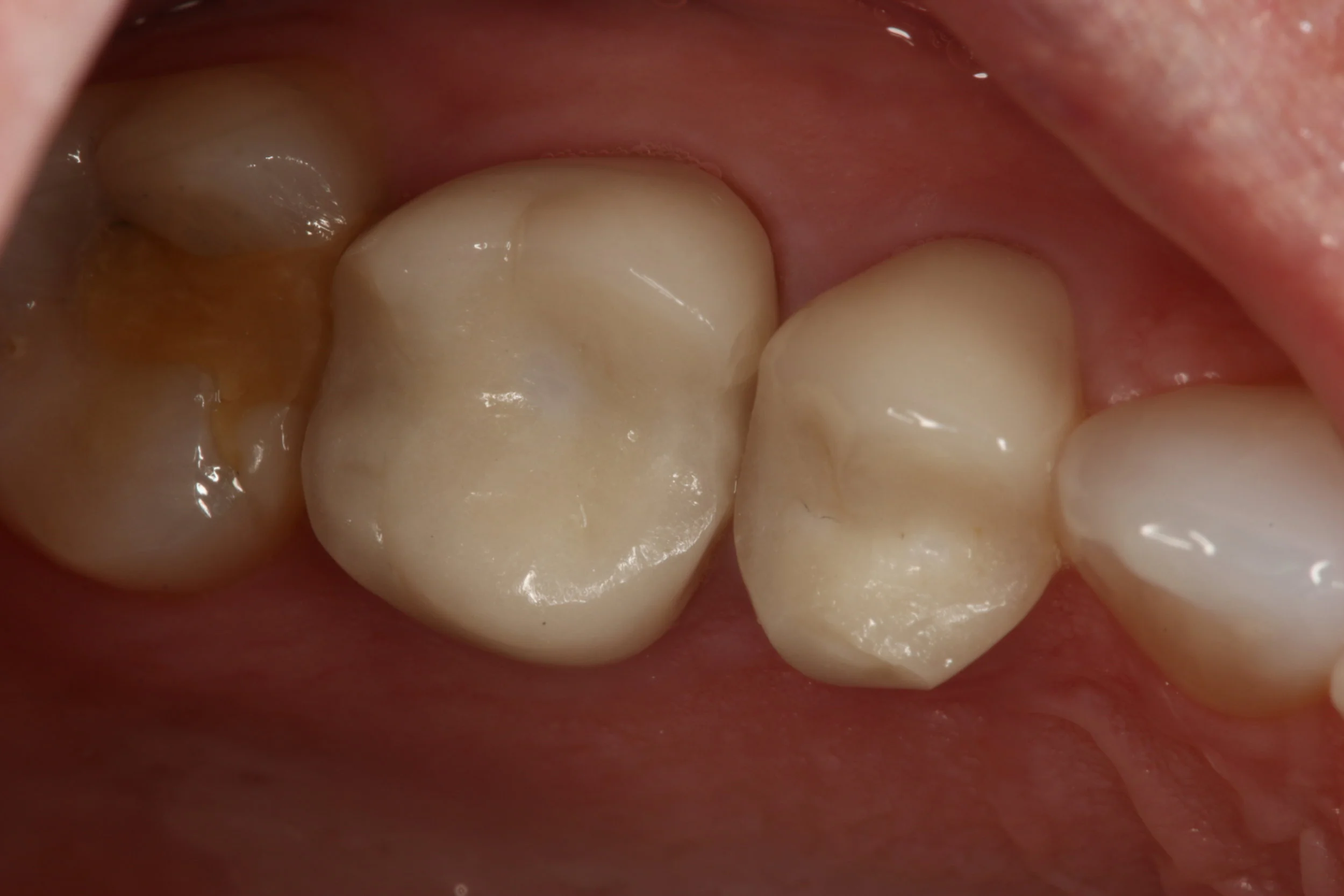 Episode 53: Practice Changers 2017- Occlusion, TMD, and Sleep Medicine