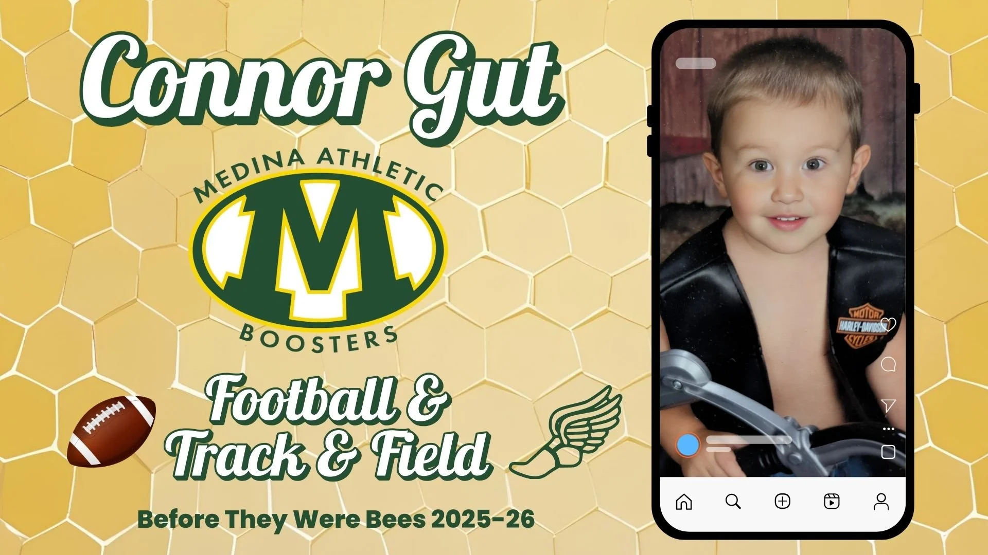 Connor Gut.jpg