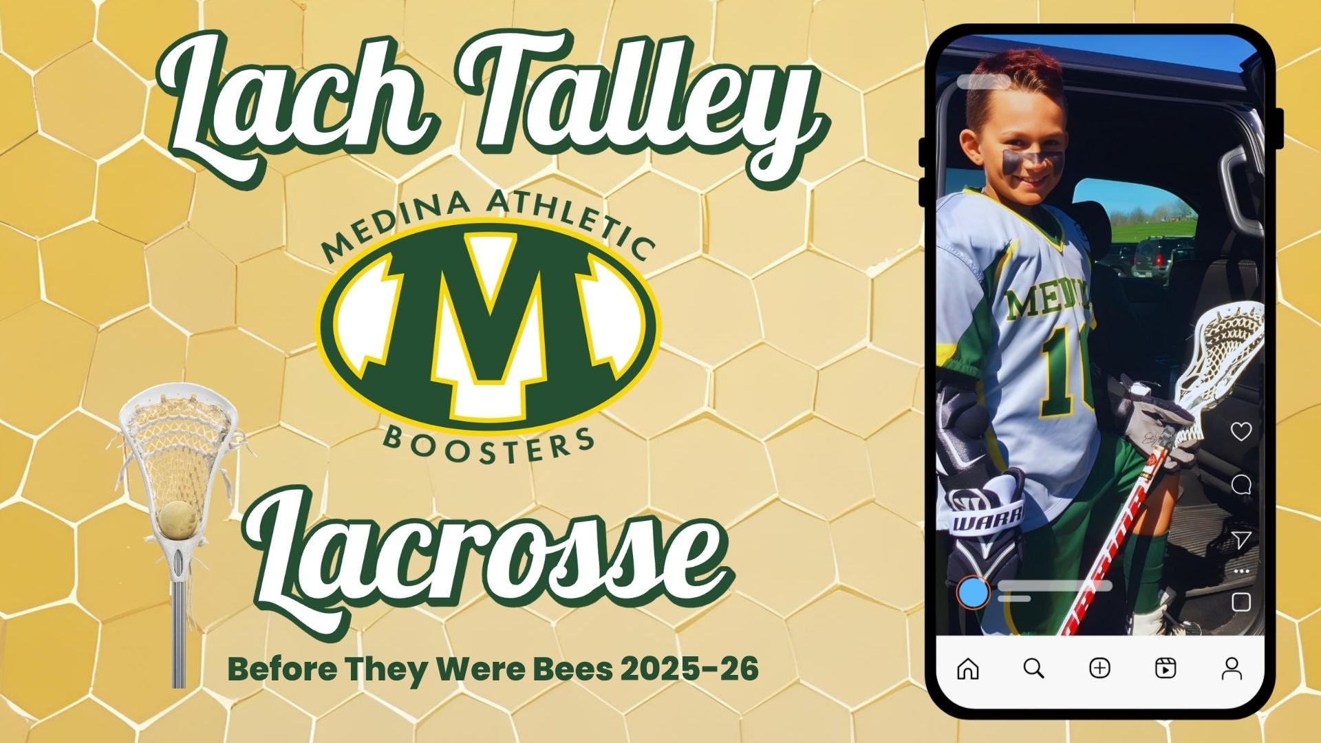 Lach Talley.jpg