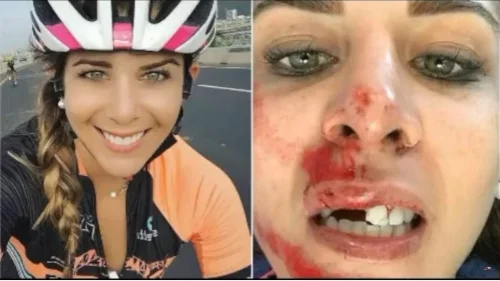 Woman Loses Two Teeth In Bunjee Jump Fail
