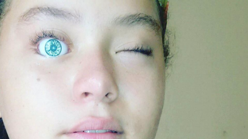 Girl Puts Doll's Eye in Her Eye Sockets, Gets Stuck