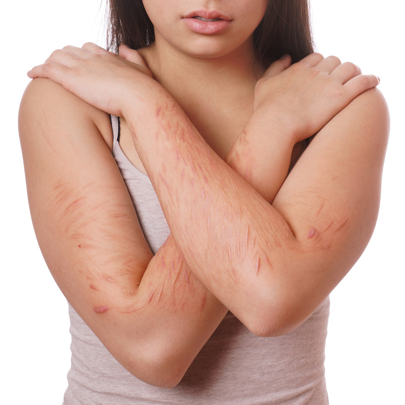 Self Injury LISA COHEN BENNETT PhD annual-reviews