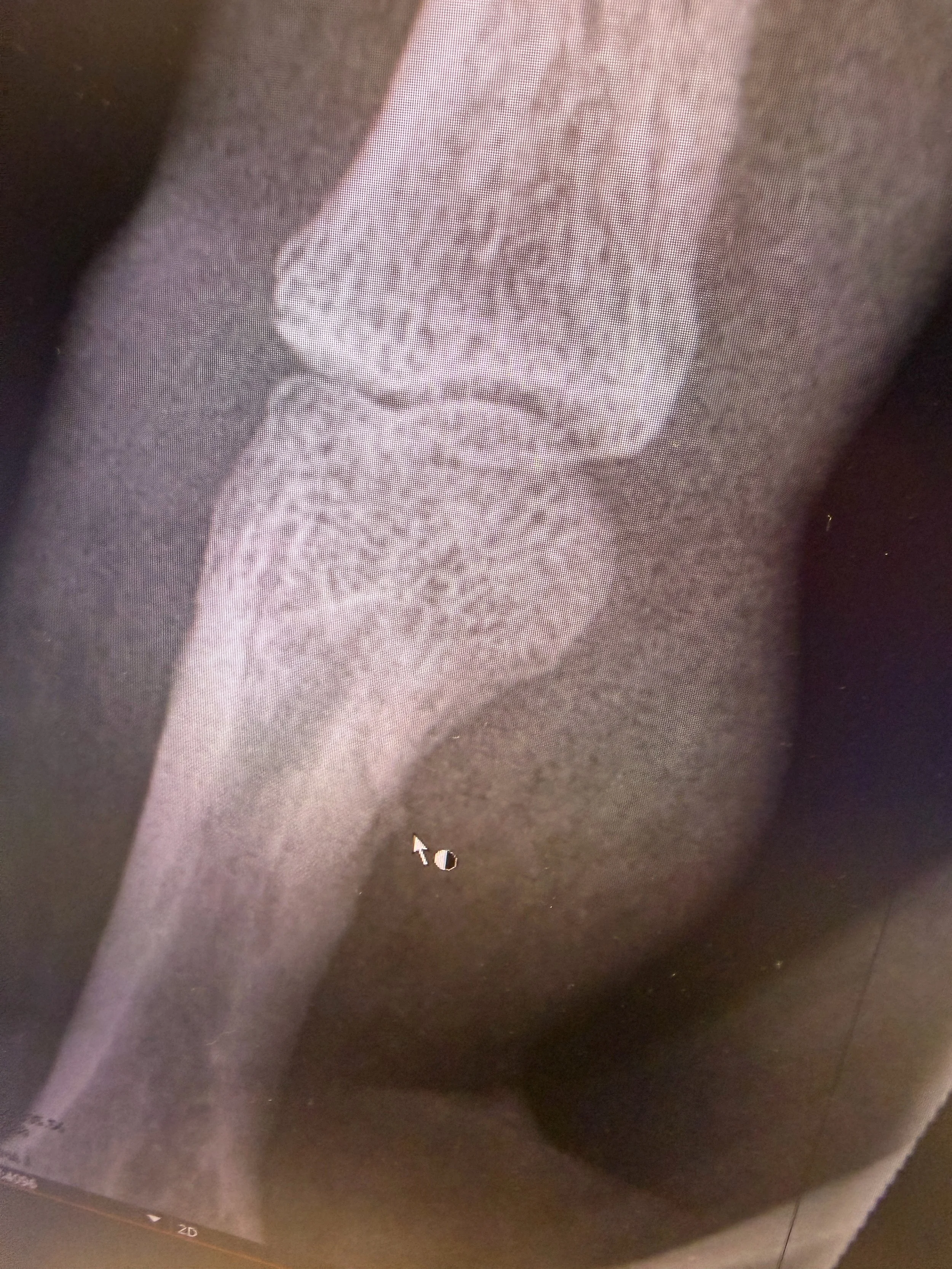 Broken During Demonstration