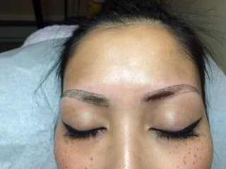 Before and After