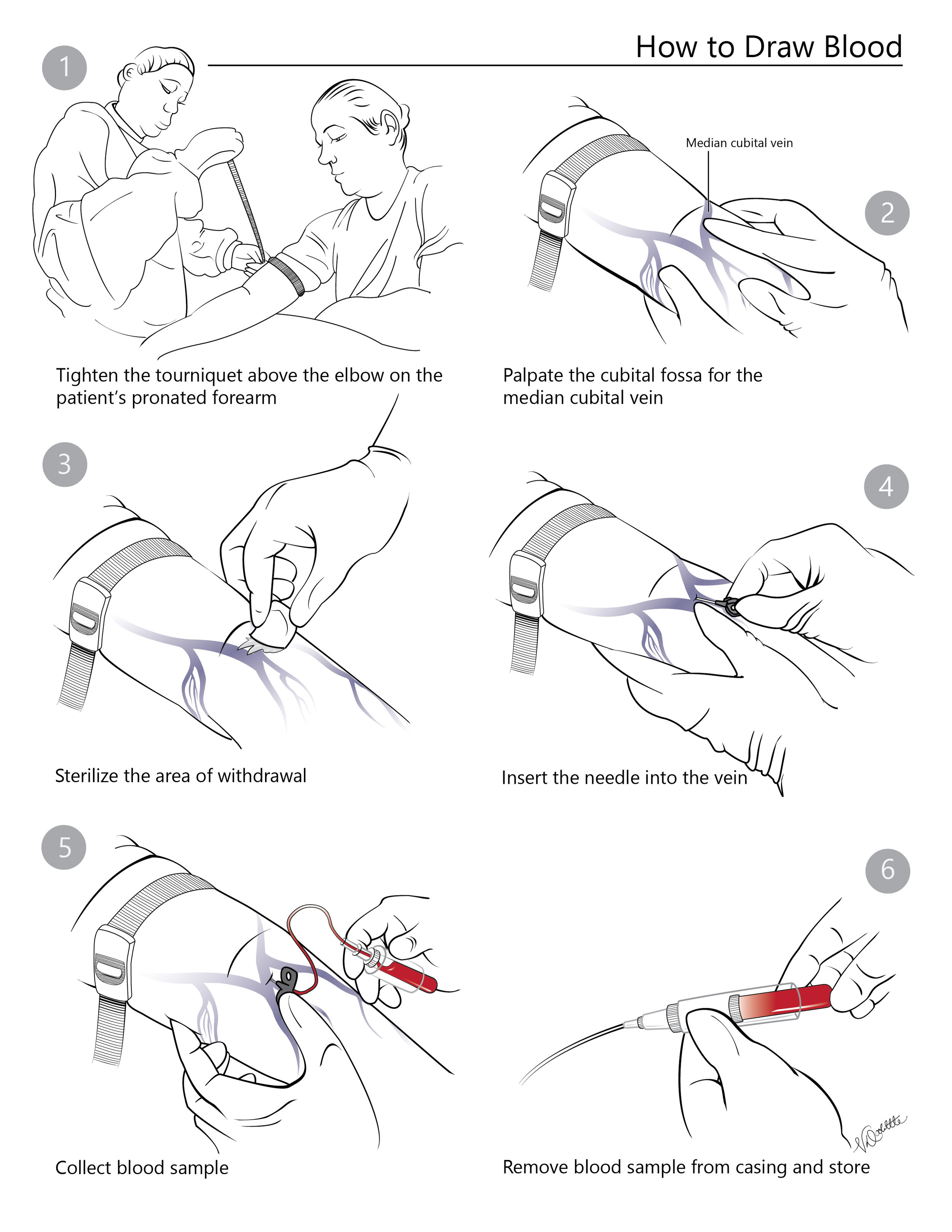 How to Draw Blood
