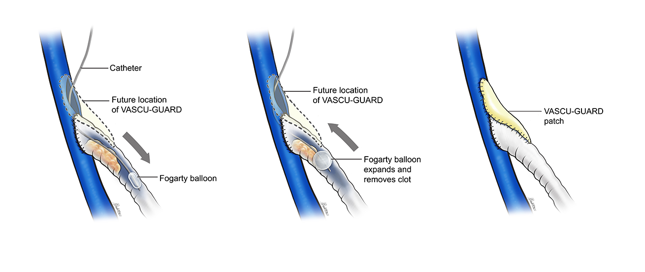 Vascular Surgery
