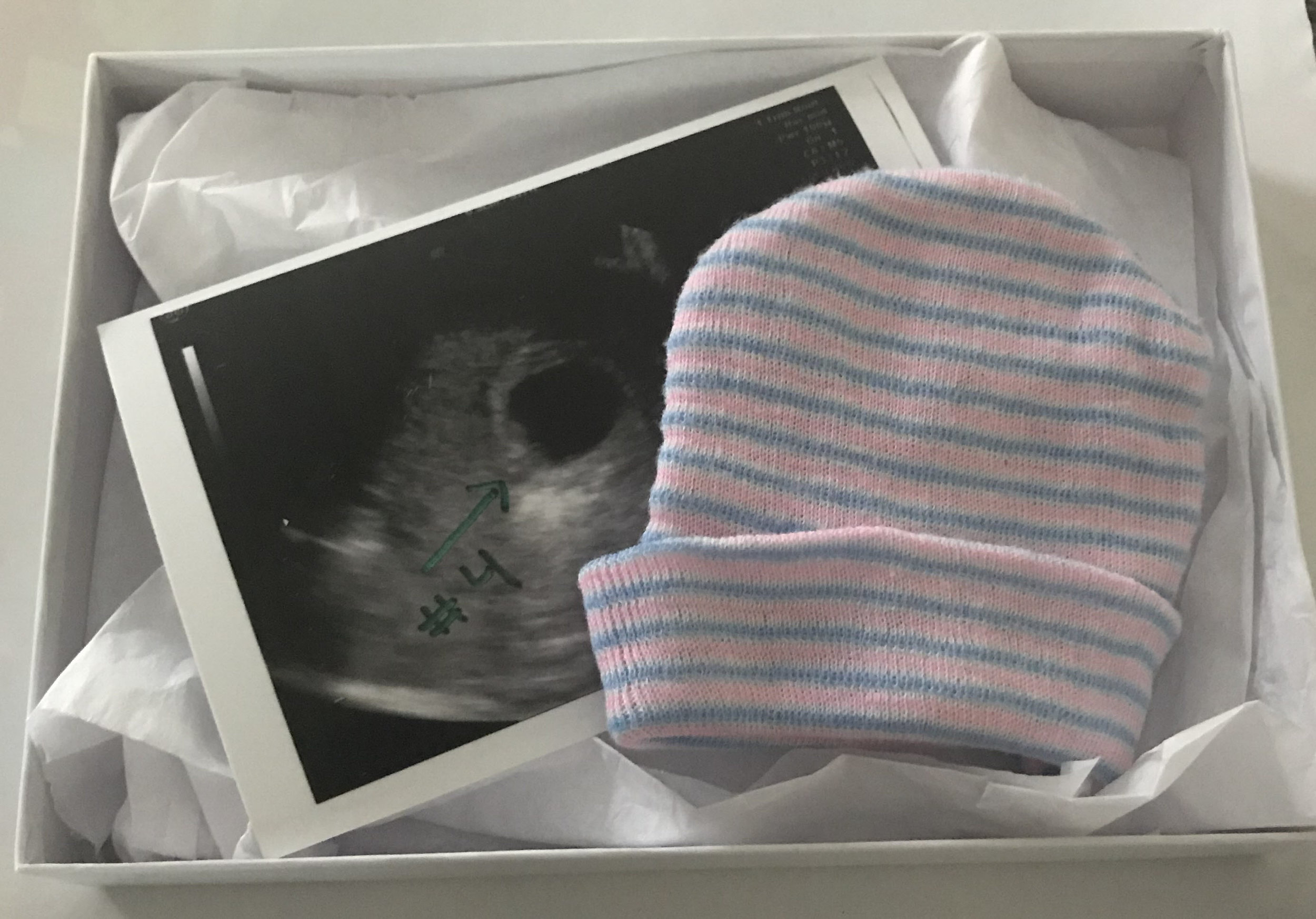 Miscarriage and Loss