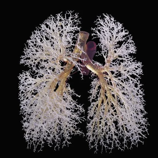 Artwork: resin cast of lungs bronchi tree