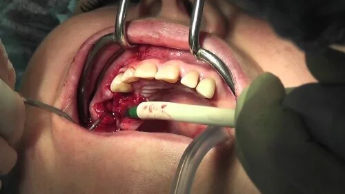 Неприятные фотографии вредят медицинской рекламе