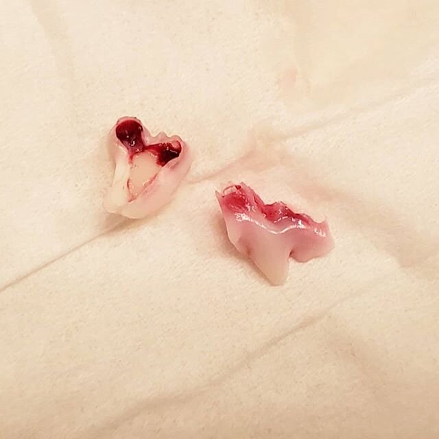 Dr. Feng's fur child Kaia lost some #puppyteeth over the holidays!

Fun facts from the AKC: At around four months of age &mdash; and it can vary from breed to breed and even from&nbsp;dog&nbsp;to&nbsp;dog&nbsp;&mdash; the 28&nbsp;puppy teeth&nbsp;are