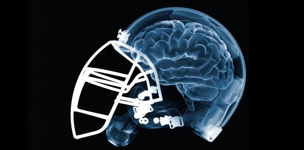 The scary reality of CTE in contact sports