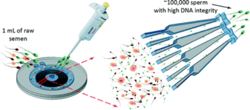 94. Rapid Selection of Sperm with High DNA Integrity