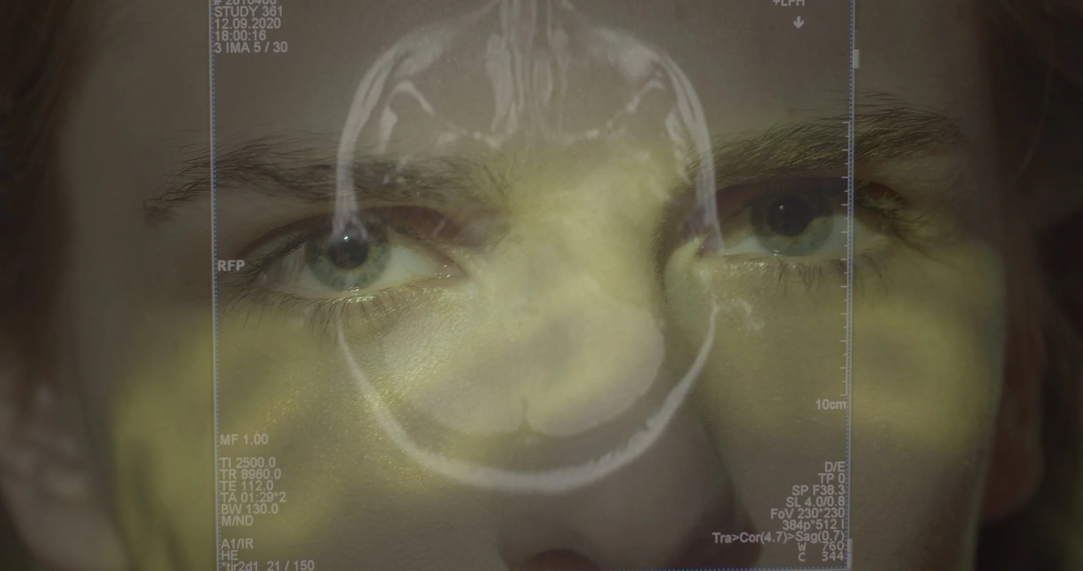 Screening &amp; Conversation: When Honey Tastes Like Metal