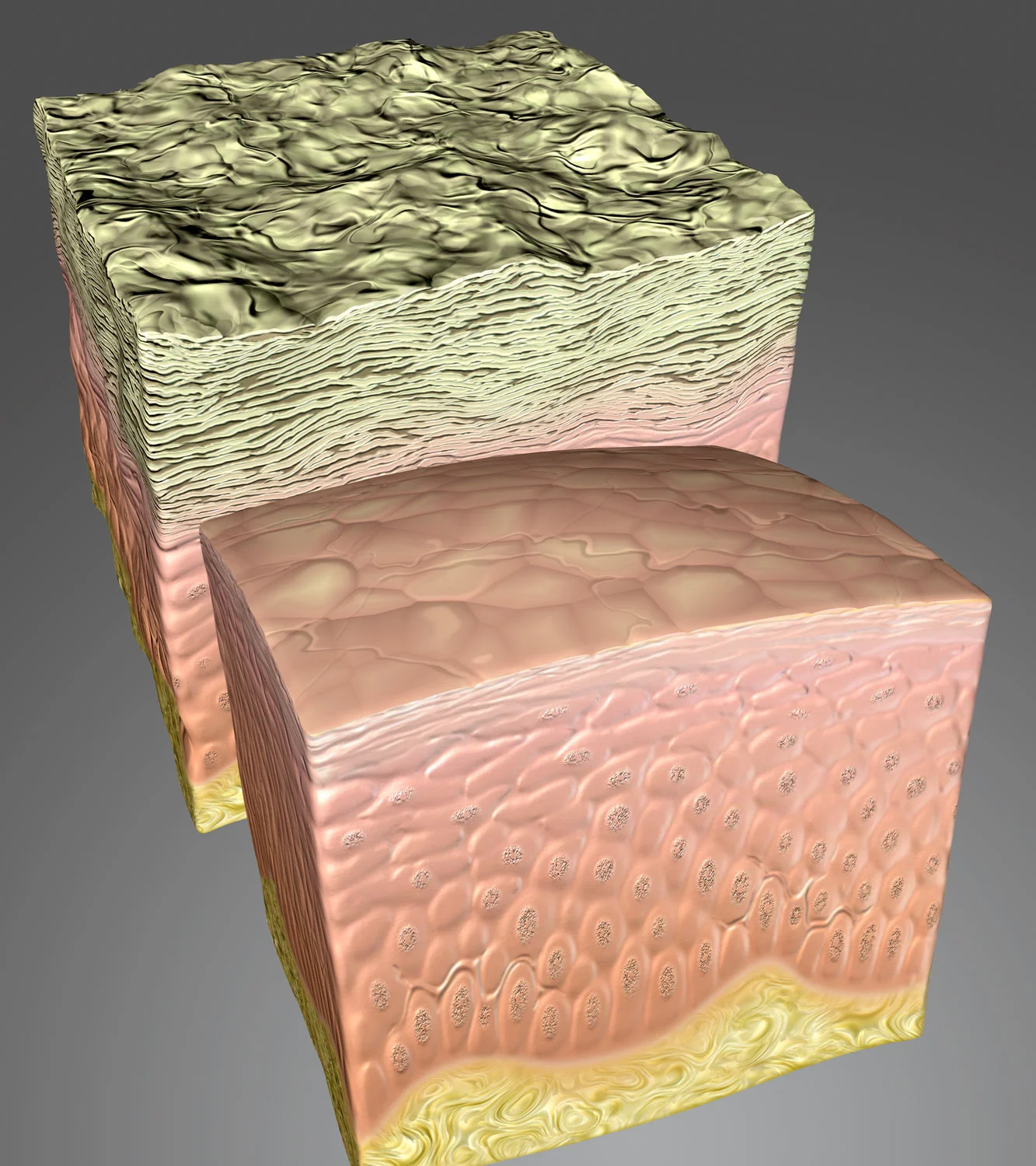 Dermabrasion