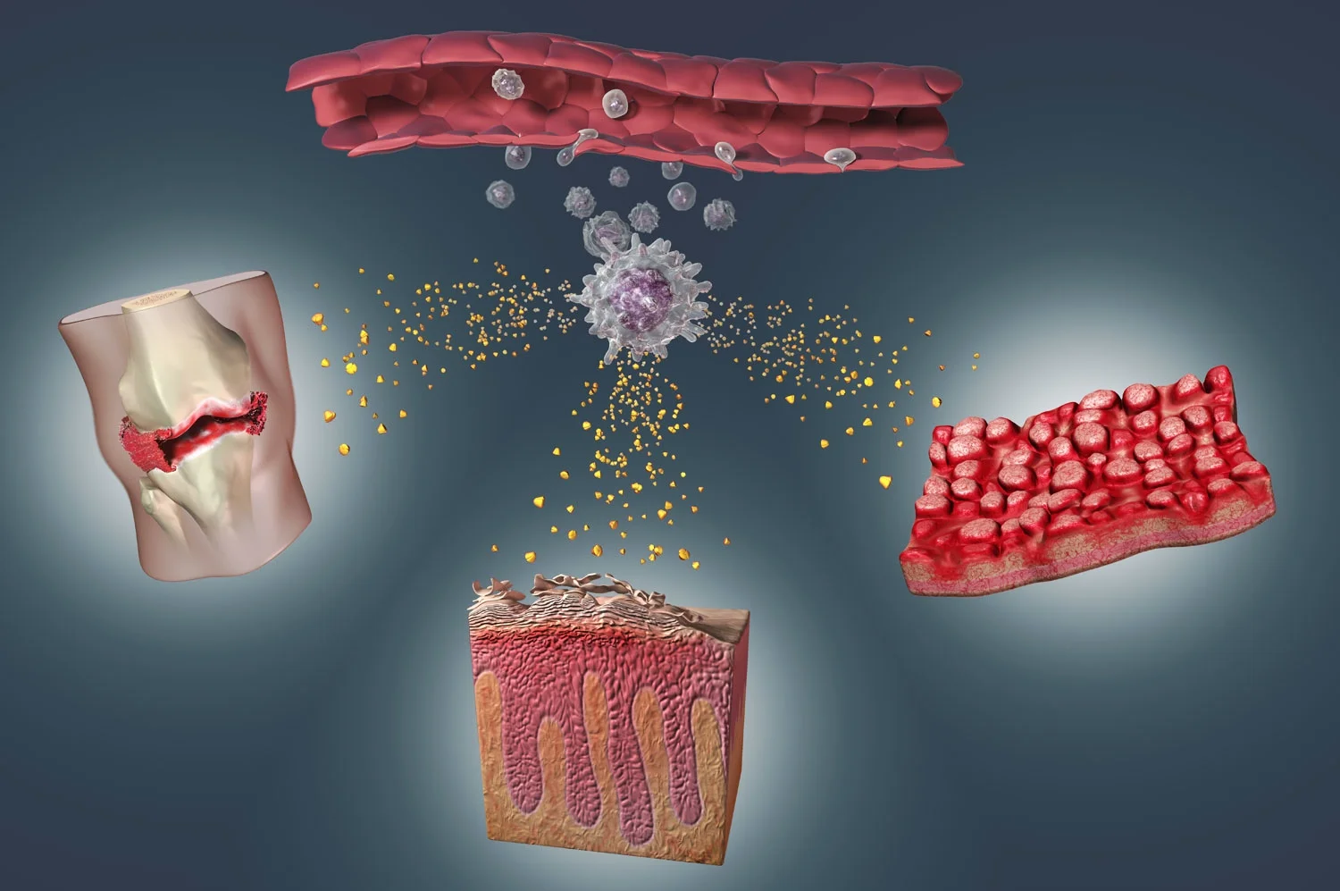 Tumor Necrosis Factor