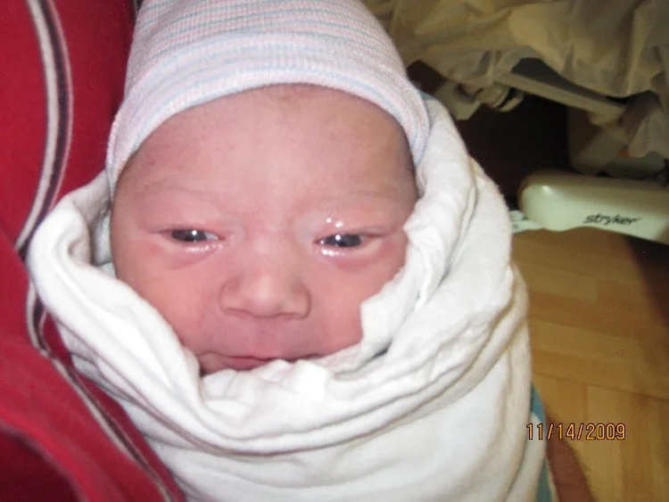 About Hb2038 And Erythromycin Eye Ointment Birth Fort Worth