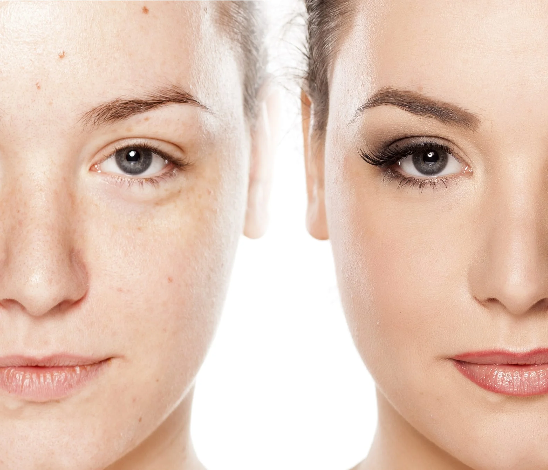 Microdermabrasion vs Chemical Peel.jpg