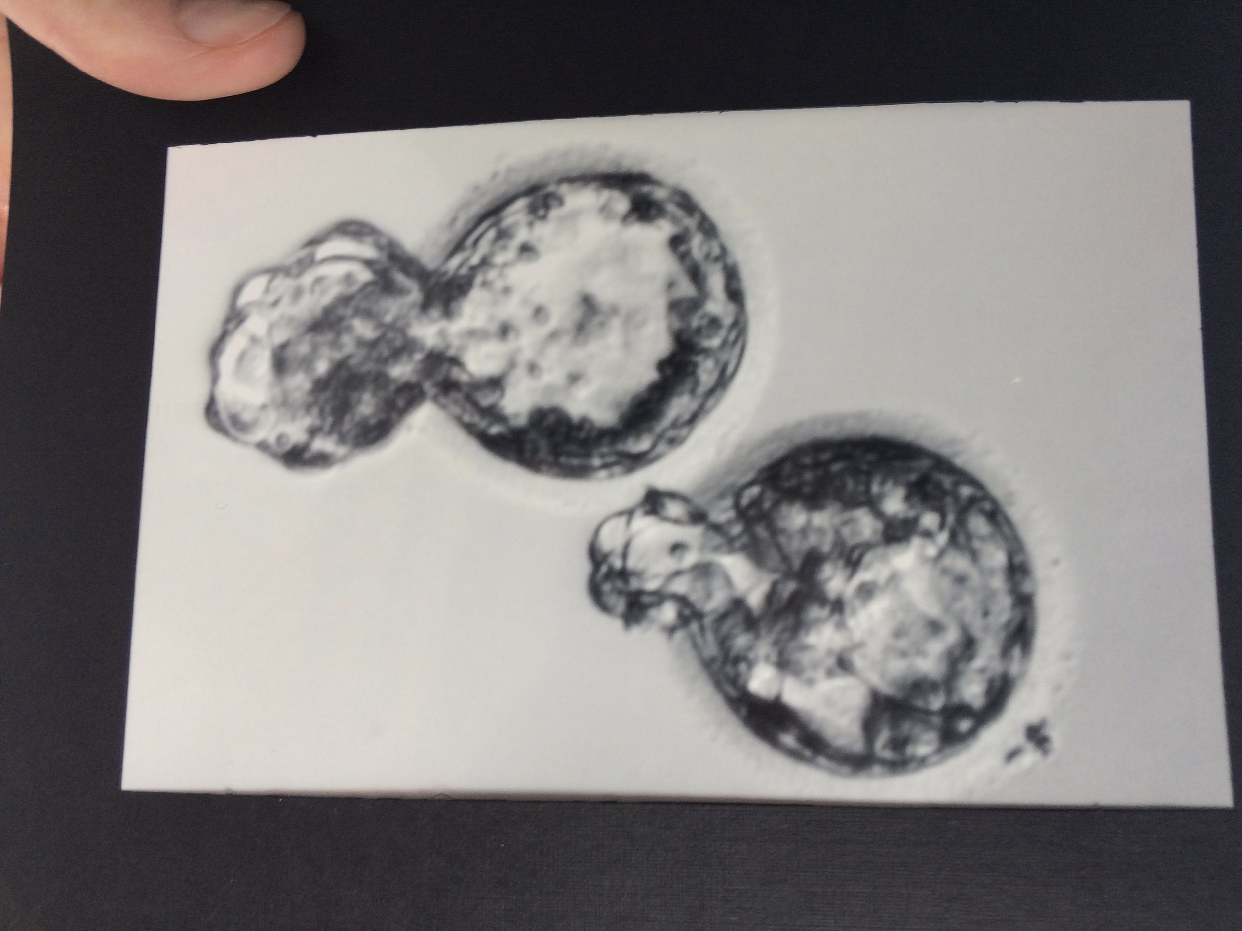 Two successfully growing embryos!