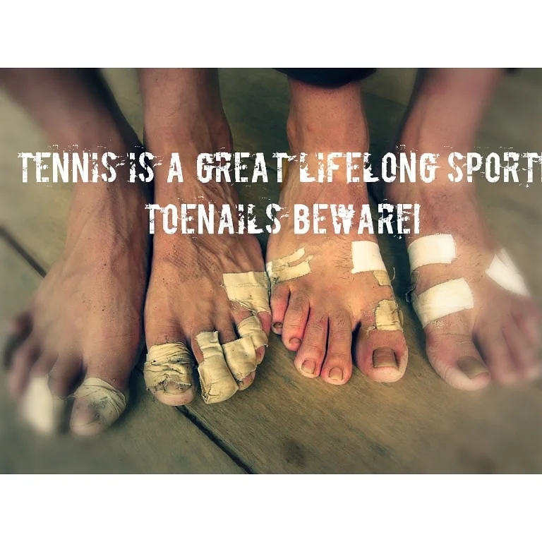 nail injury tennis.jpg