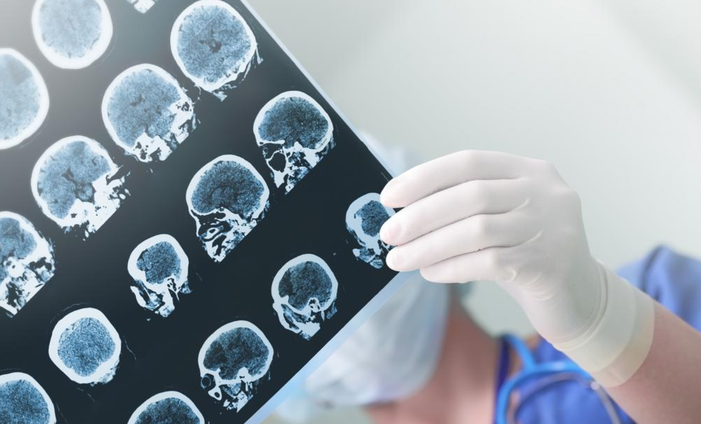 neuro.png