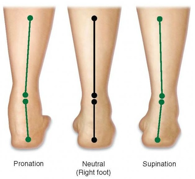 high arch pronation