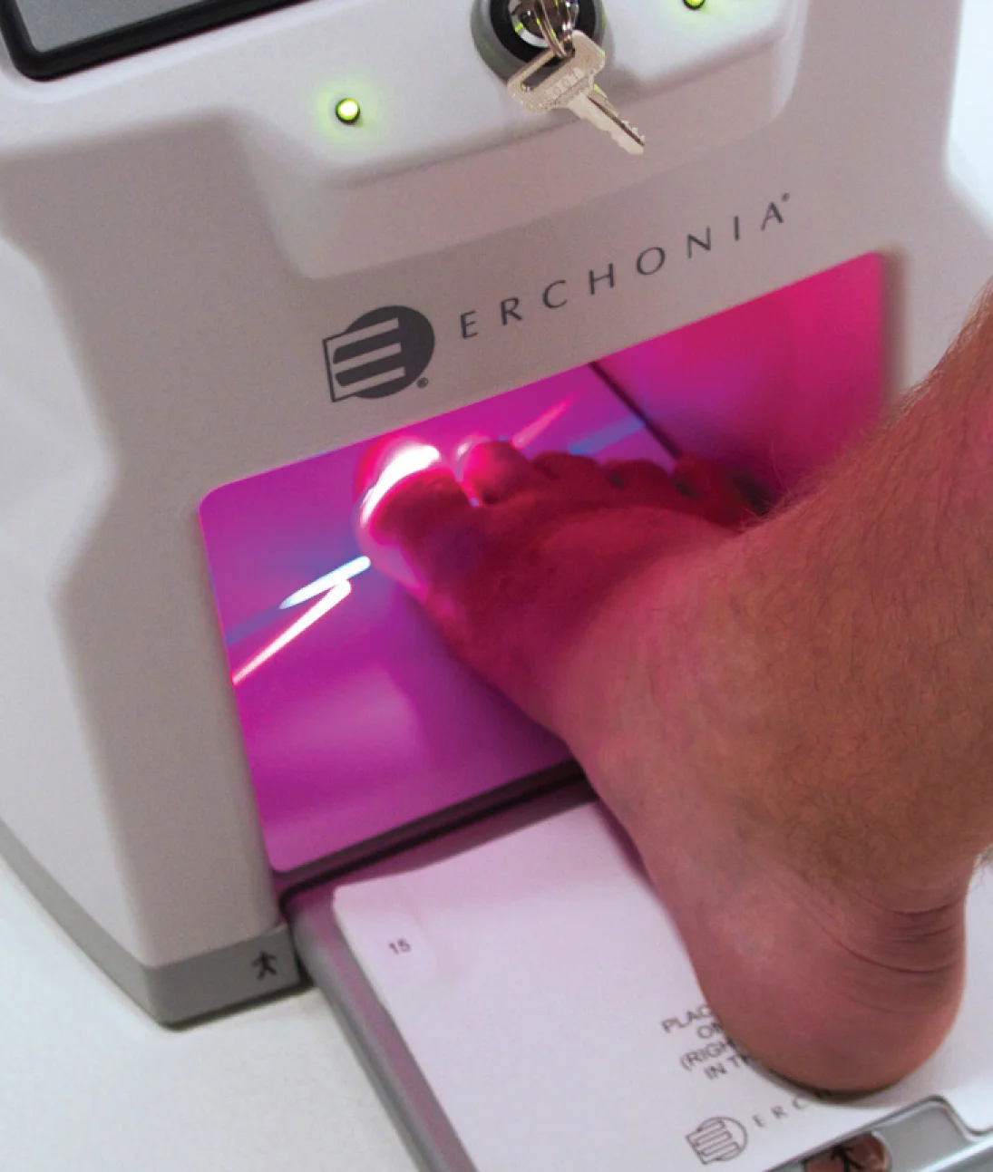 Lunula_Foot Being Lasered.jpg