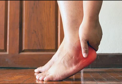 Heel Pain: Plantar Fasciitis & Heel Spurs | Bakewell Osteopathy Clinic