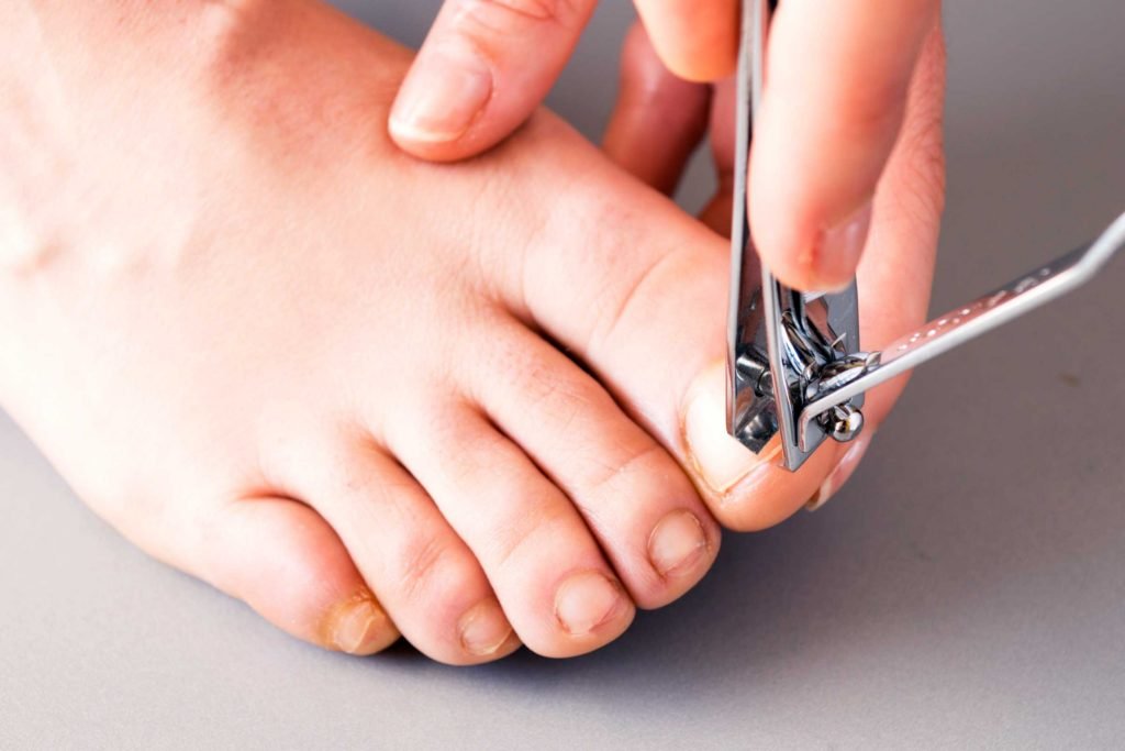 How to Fix Ingrown Toenails, Cures According to a Podiatrist – Footwear News
