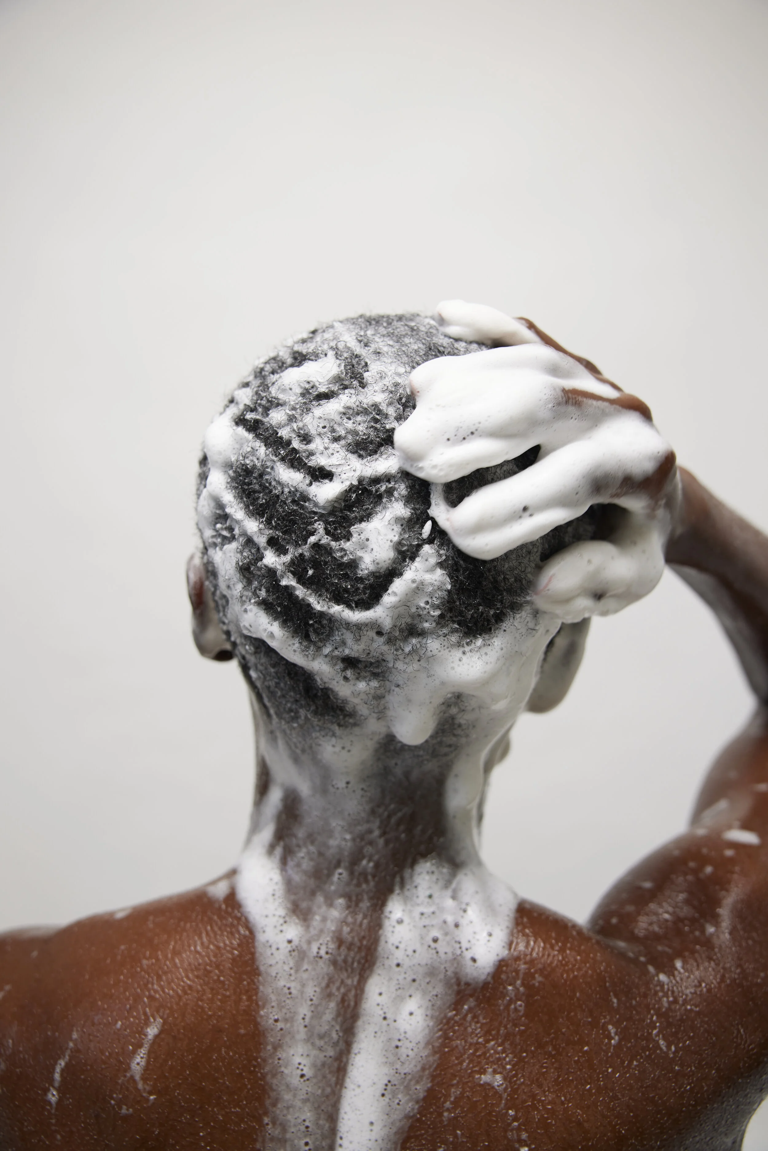 PSORIASIS HONEY3301.jpg