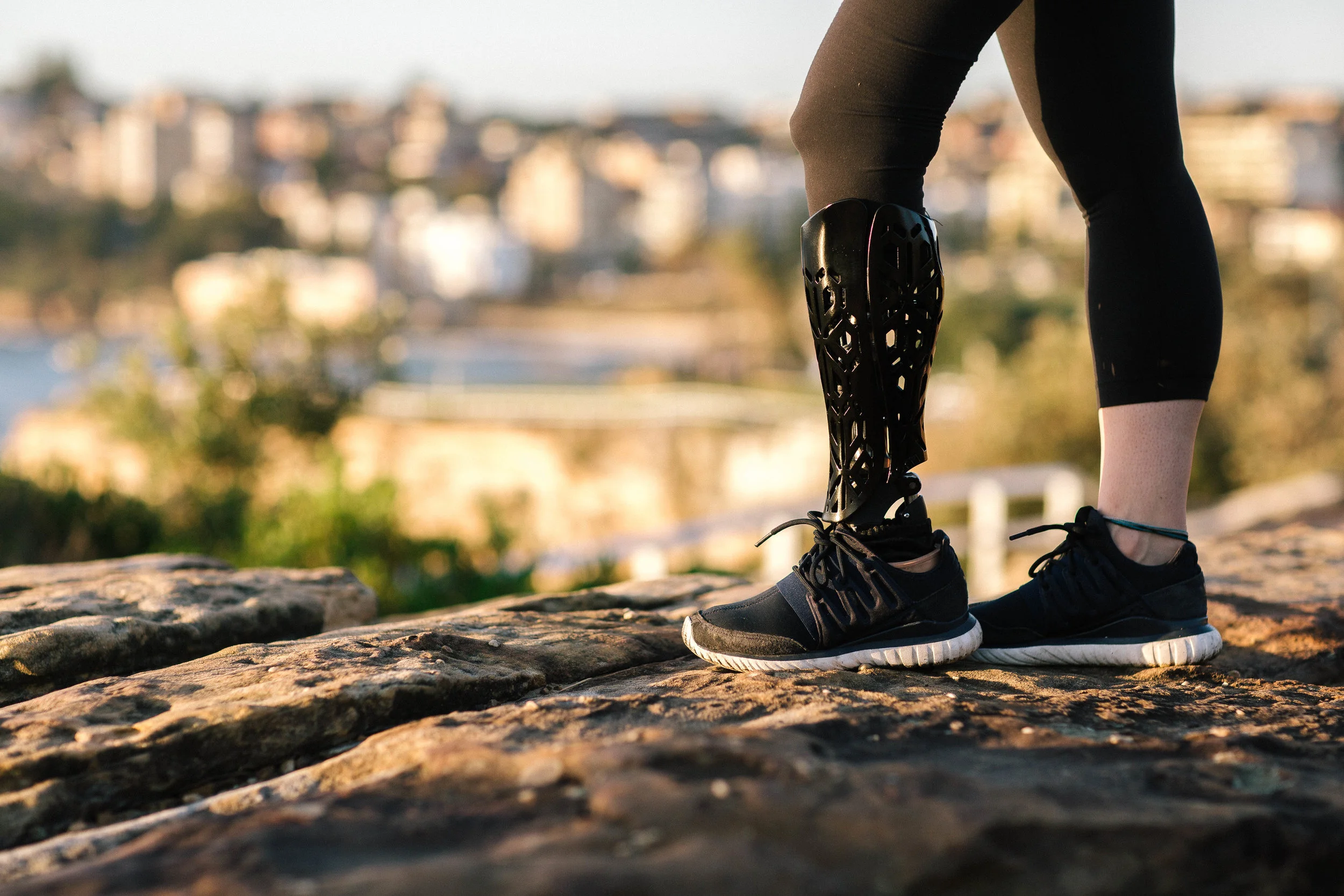 Form Prosthetics custom cover