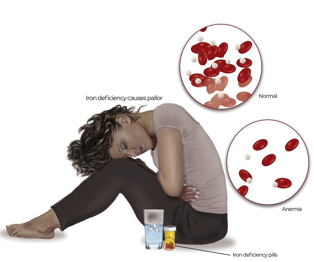 Anaemia+Correction.jpg