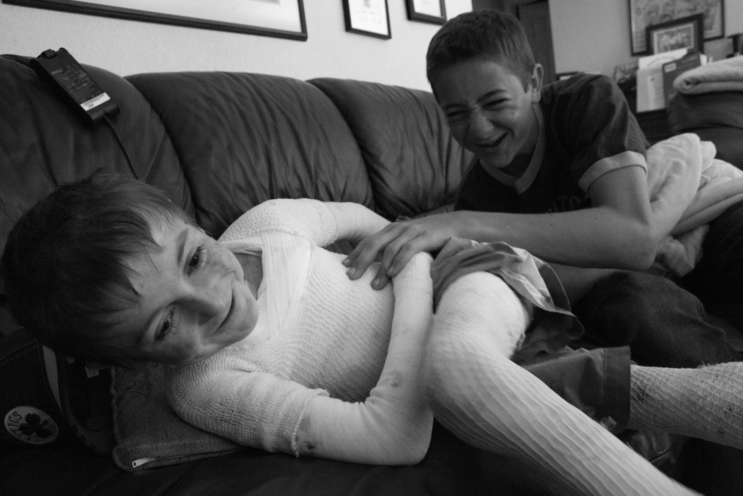  Born with Epidernolysis Bullosa, Garrett Spaulding's skin is very sensitive and is hurt easily. But, leave it to his older brother, David, to find a way to tickle and rough house with his younger brother without hurting him. (Credit Image: Andre J. 