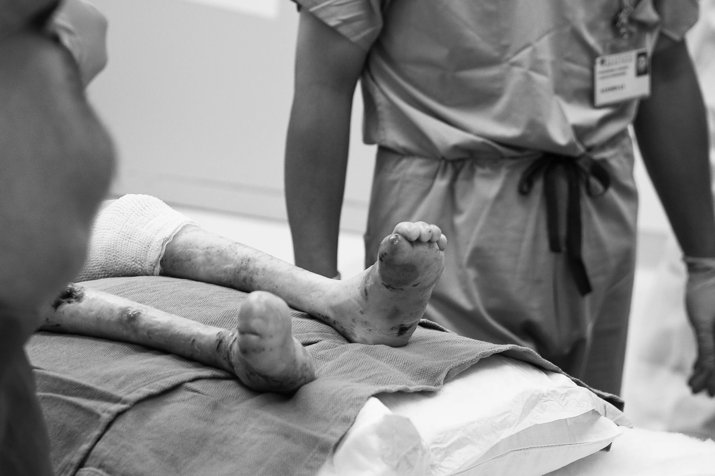 epidermolysisbullosa-3323.jpg