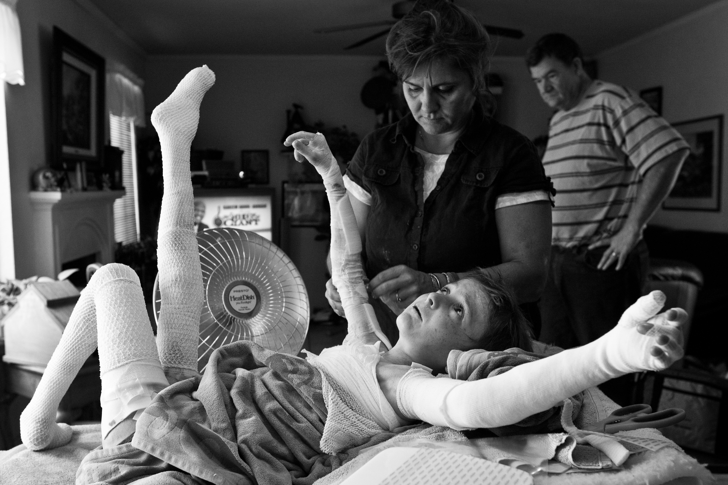  Garrett Spaulding, 12, holds a very uncomfortable position while his mom changes the bandges around his shoulders. Born with Epidermolysis Bullosa, Garrett must have his bandages changed up to 3-times per week. 