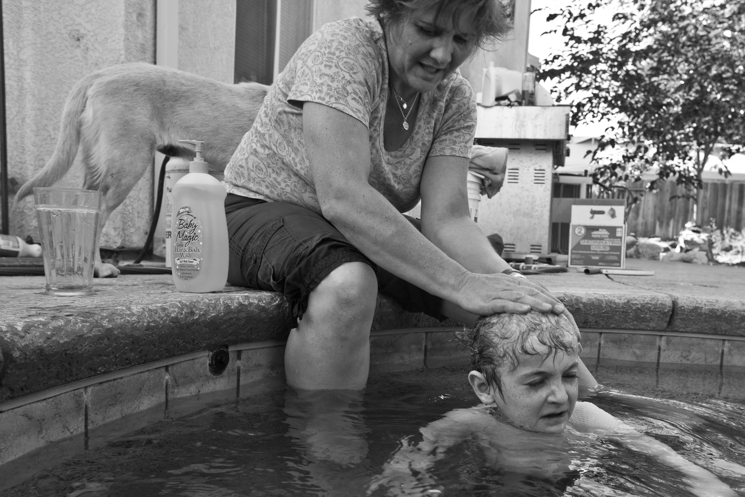 Garrett is extremely afraid of bath tubs. His mom can't explain it. He prefers to soak his bandages and be bathed outside in the family jacuzzi. In order for his mom to do this without causing infection, she must monitor the chlorine levels in the water daily.