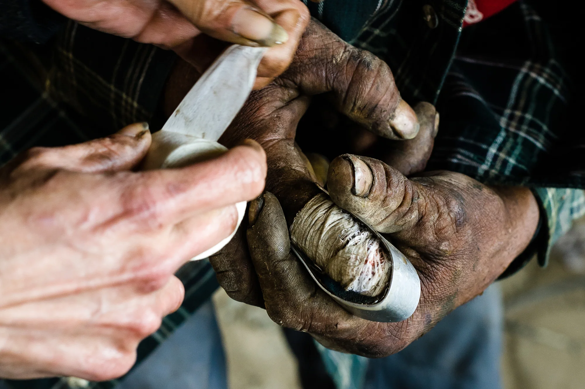 Boudreaux, another of the camp's veteran scrappers gets help reapplying a bandage and splint. Recently he lost the tip of his finger at the first joint to a scrapping accident.